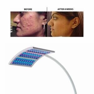 Trophy Skin BlueMD Acne Treatment Light Therapy EUC $285+ retail